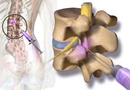 ortho clinic in Kondapur,hyderabad