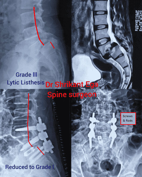 ortho clinic in Kondapur,hyderabad