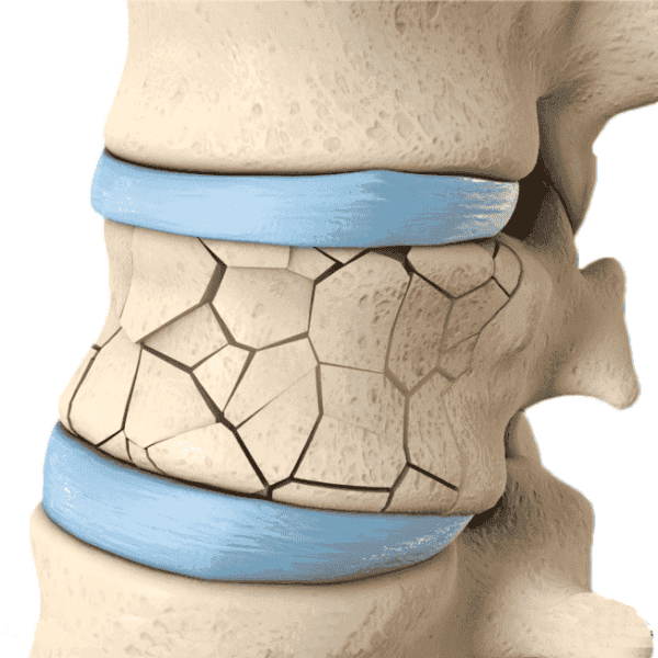 Best Back Surgeons Near me | Spine Sure Clinic